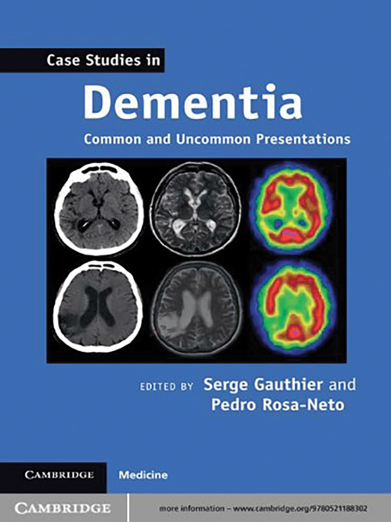 case study person with dementia