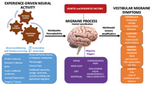 Vestibular migraine | ACNR